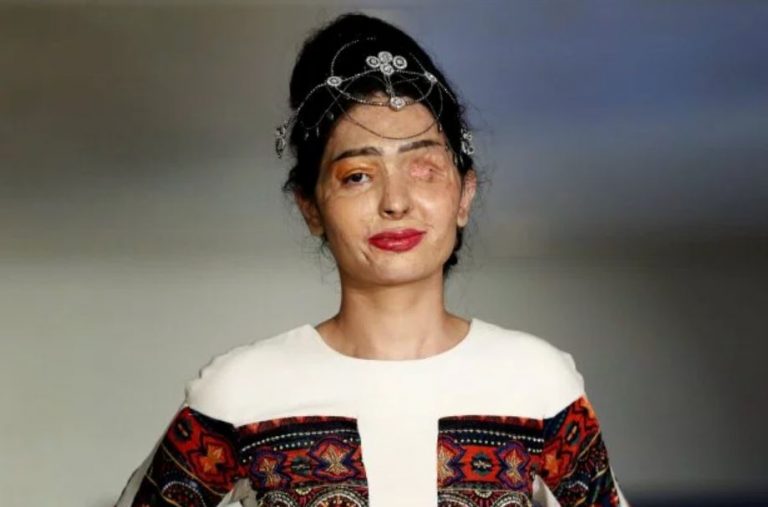 ataques_acido_desfile_moda_elzocco